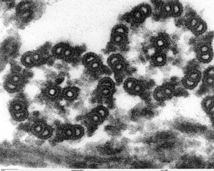 Chlamydomonas_TEM_17