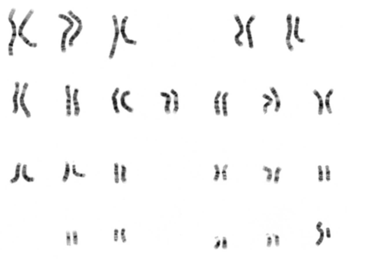 Karyotype