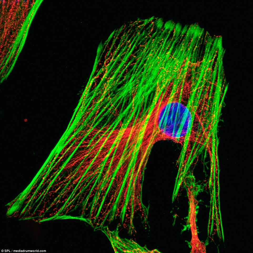 39426B9E00000578-3830419-A_fluorescent_light_micrograph_of_a_HeLa_cervical_cancer_cell_sh-a-15_1476094107062